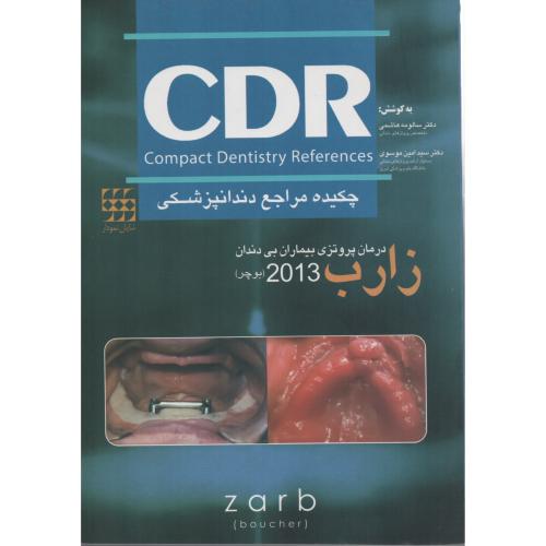 CDR درمان  بیماران  بی دندان  زارب (بوچر)