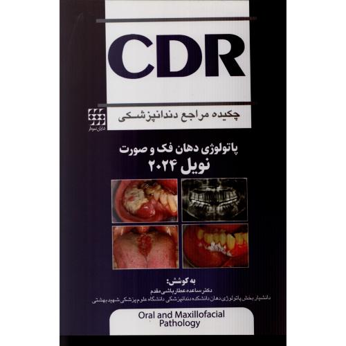 CDR چکیده پاتولوژی دهان فک و صورت نویـل  2024